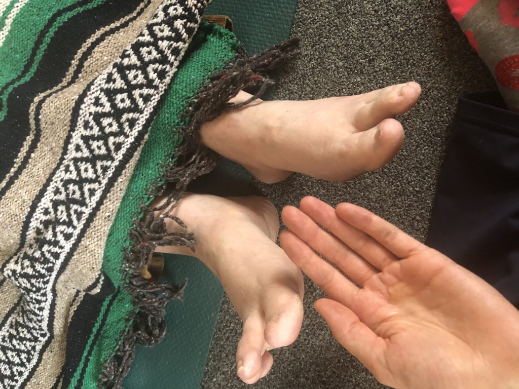 What is Ayurveda, the sister science of yoga? Wisdom Within